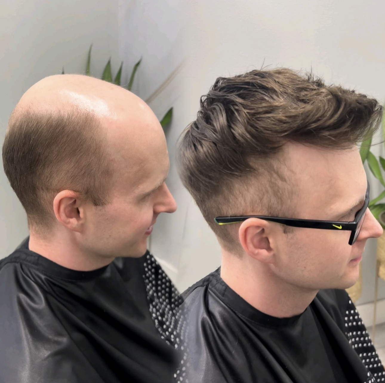 Hair system consultation style example in Charlotte, North Carolina