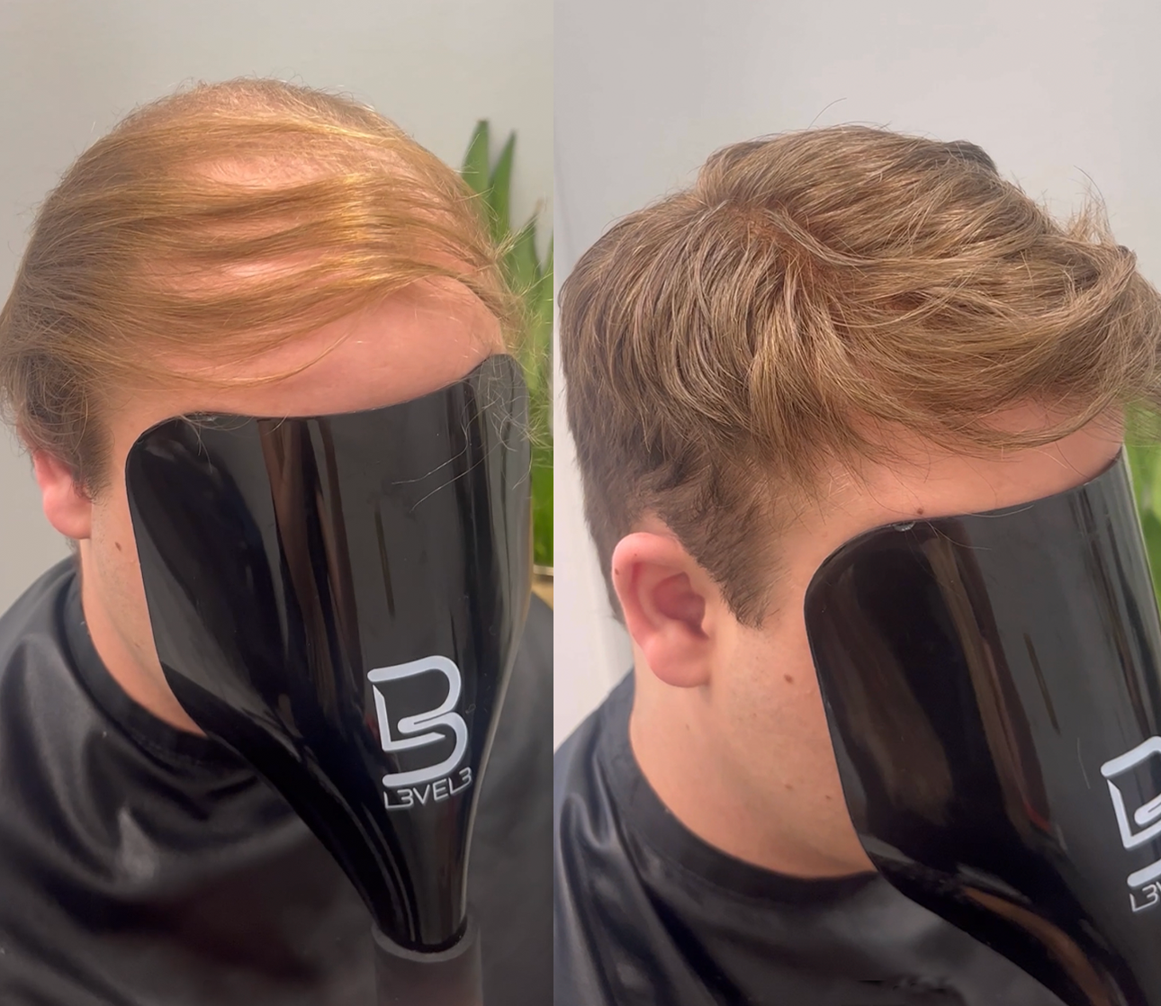 Fuller-looking hair system style example in Charlotte, North Carolina