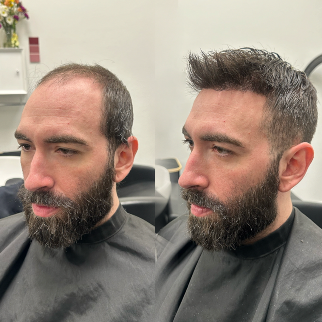 Hair unit coverage example for Charlotte, North Carolina