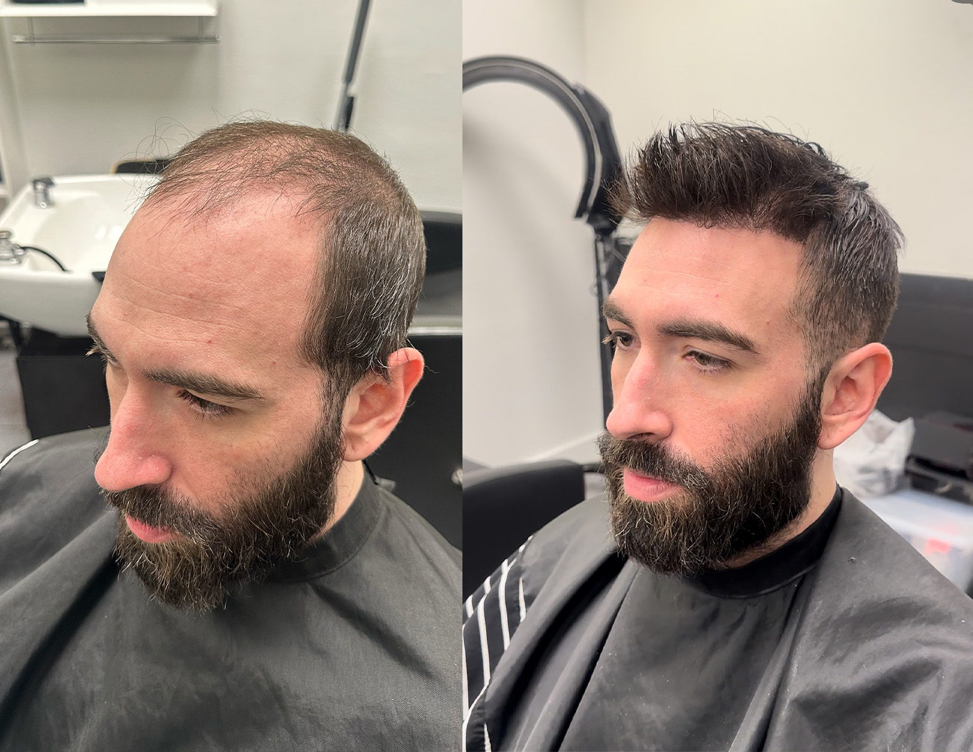 Hair system before-and-after style example